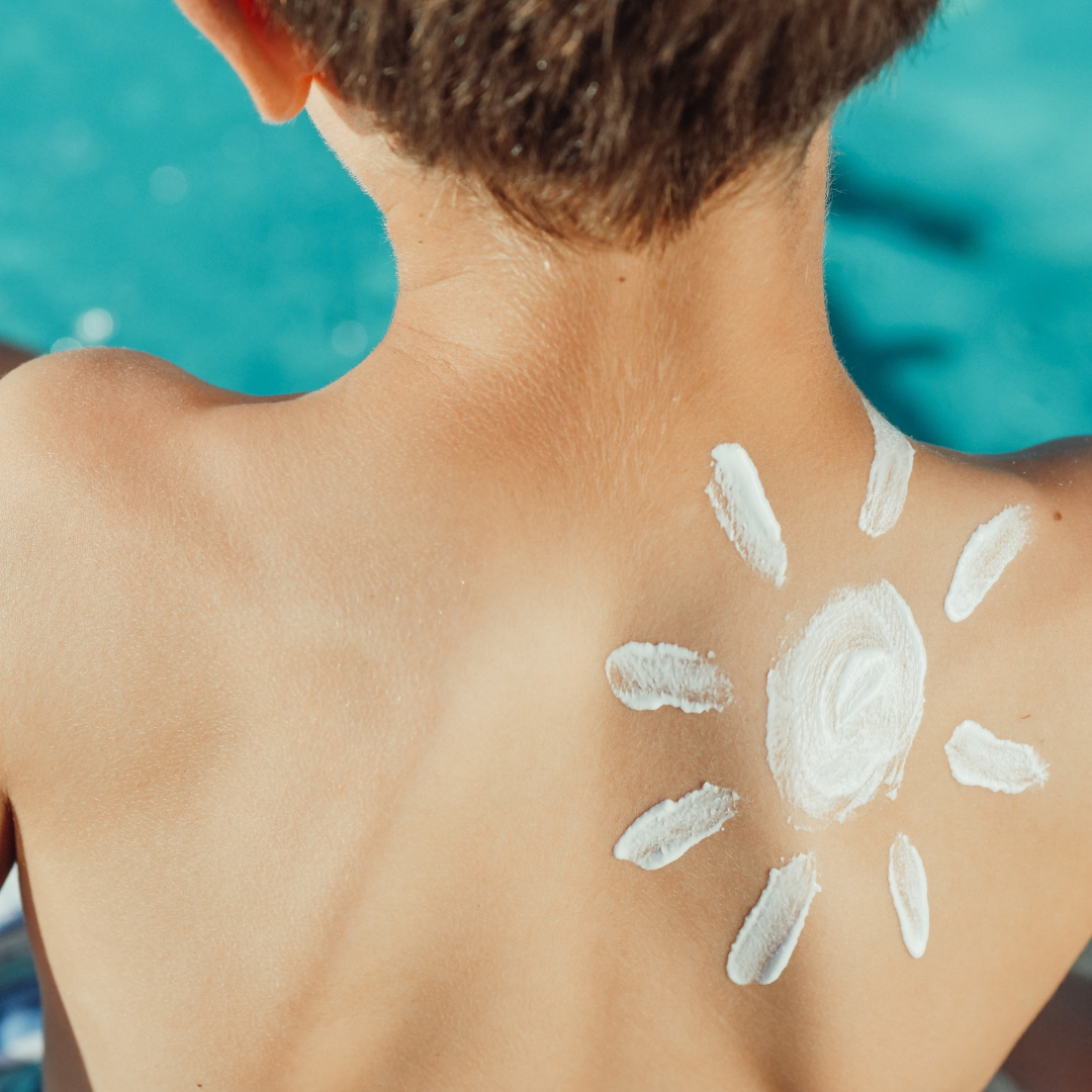 sonnenschutz: Junge mit einer auf den Rücken gezeichneten Sonnencreme-Sonne 